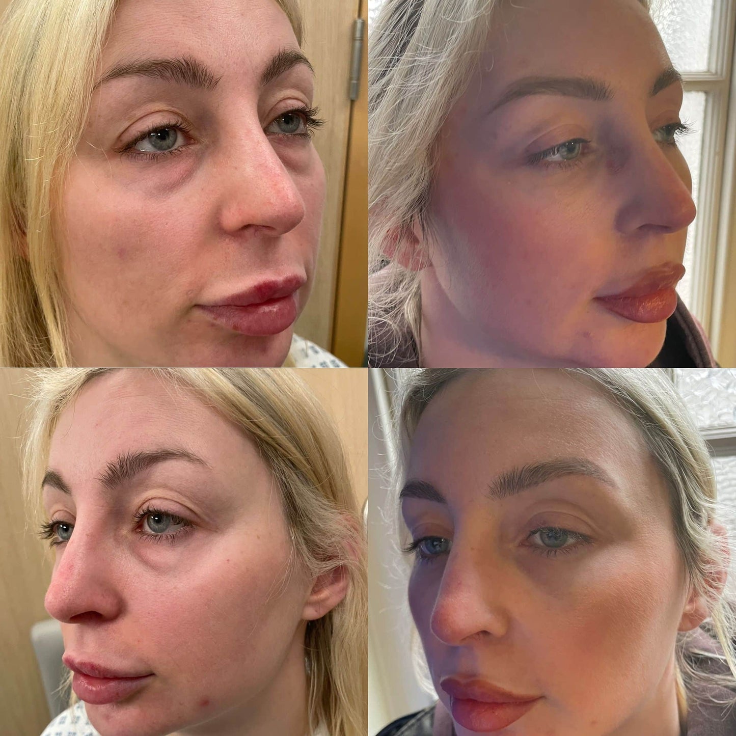 Instant Eye Tightening Cream